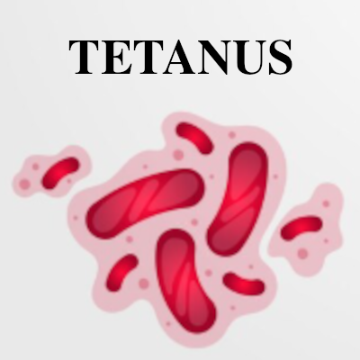 Image of Tetanus